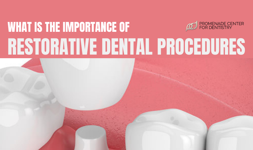 Featured image for “What Is The Importance Of Restorative Dental Procedures?”