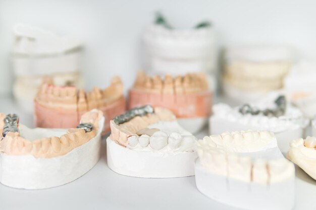 Featured image for “All You Need To Know About Dental Restoration”