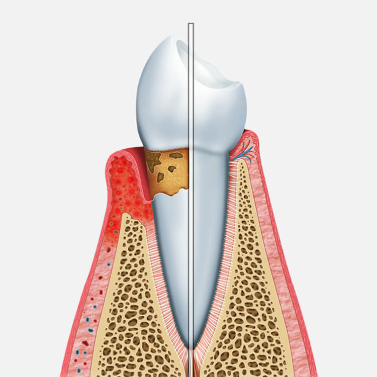 Periodontist - Promenade Center For Dentistry