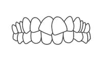 generally-straight-teeth